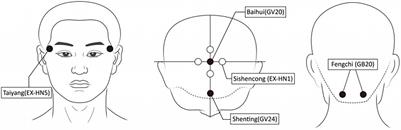 Acupressure and Cognitive Training Can Improve Cognitive Functions of Older Adults With Mild Cognitive Impairment: A Randomized Controlled Trial